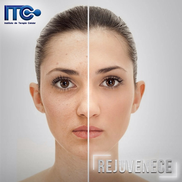 Slider image (2) Instituto de Terapia Celular - Stem Cell Guadalajara Mexico